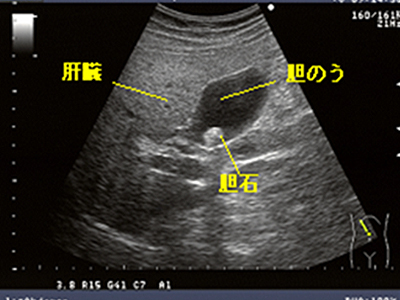 テストの後はどうなりますか?